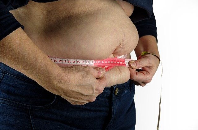 Weight Loss Surgery